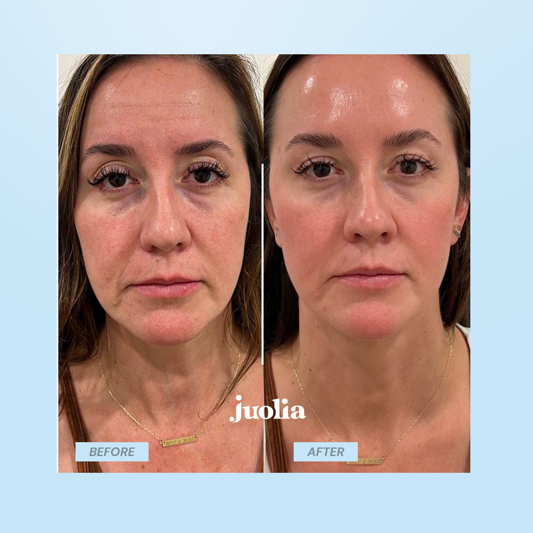 Juoli Contour Pro
