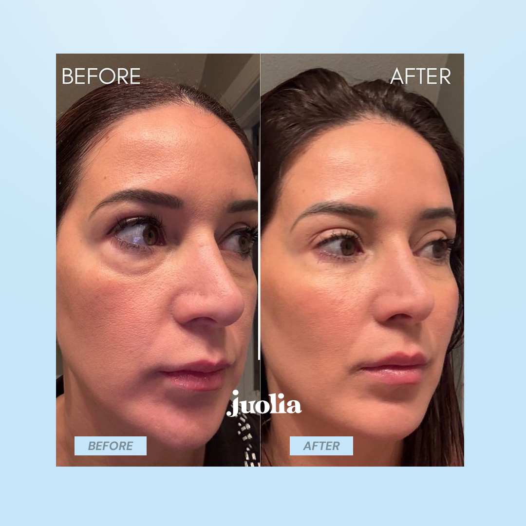 Juoli Anti-Aging Patches