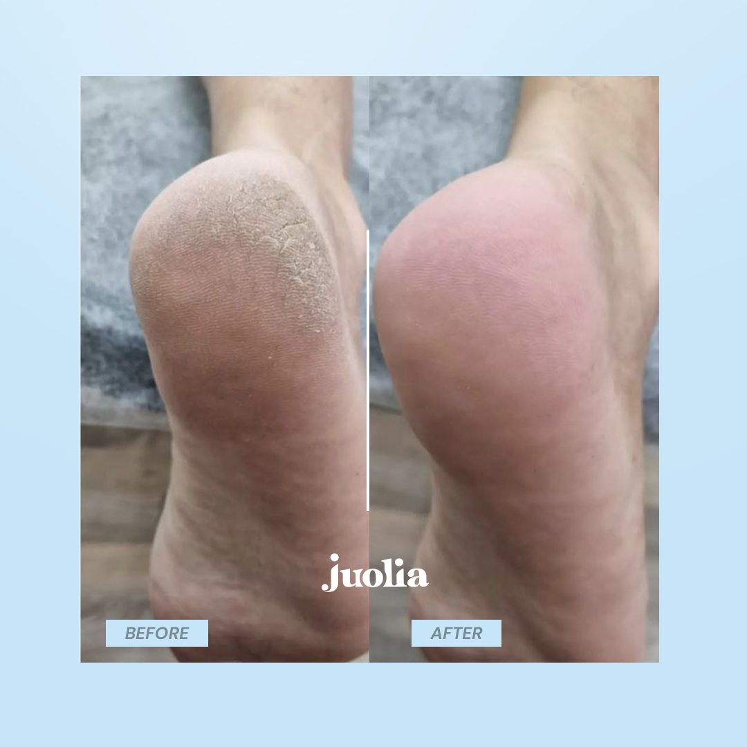 Juoli Feet Smoother