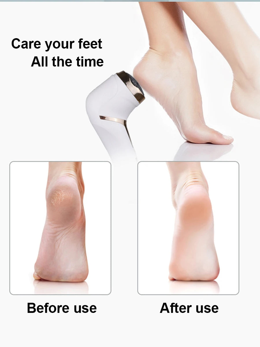 Juoli Feet Smoother