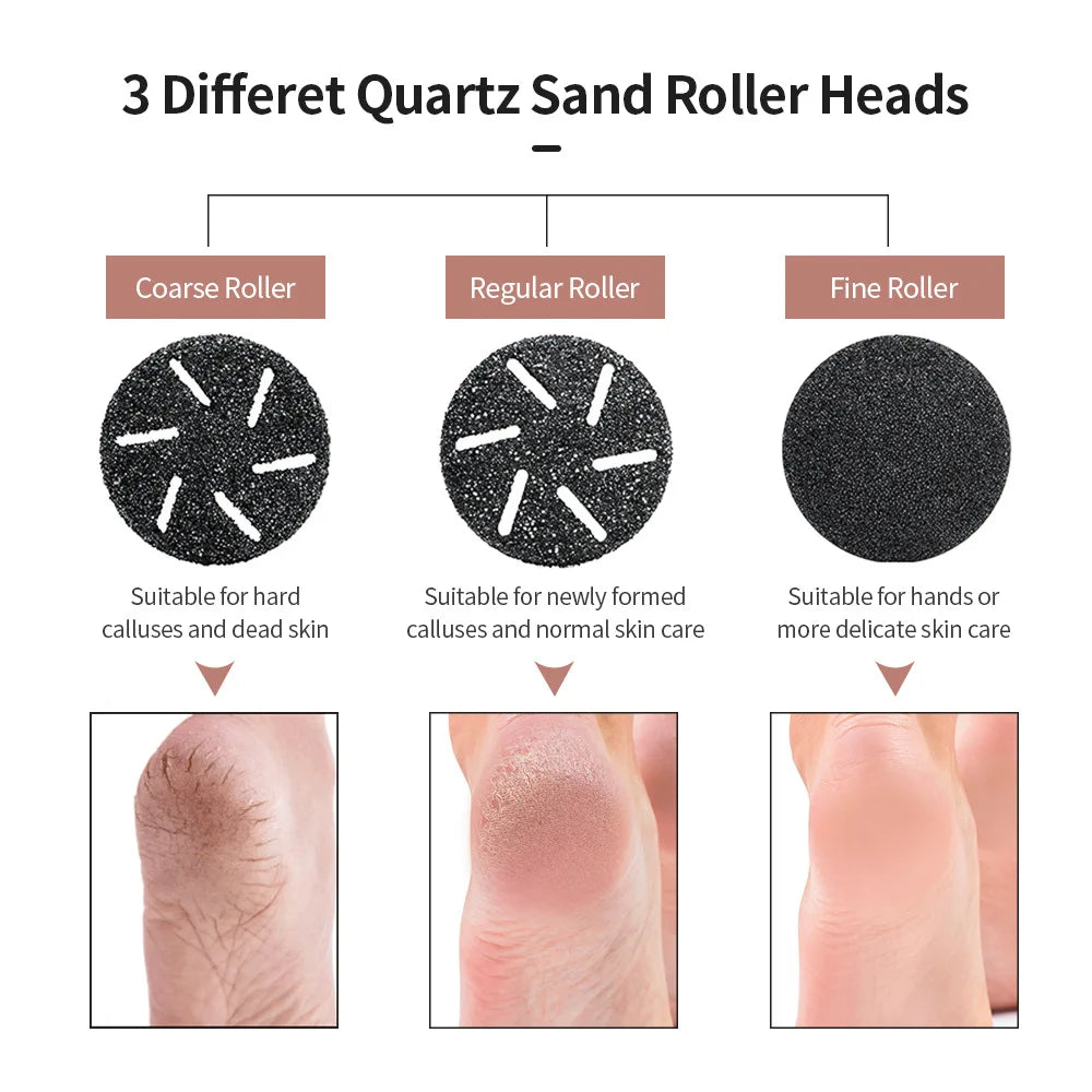 Juoli Feet Smoother